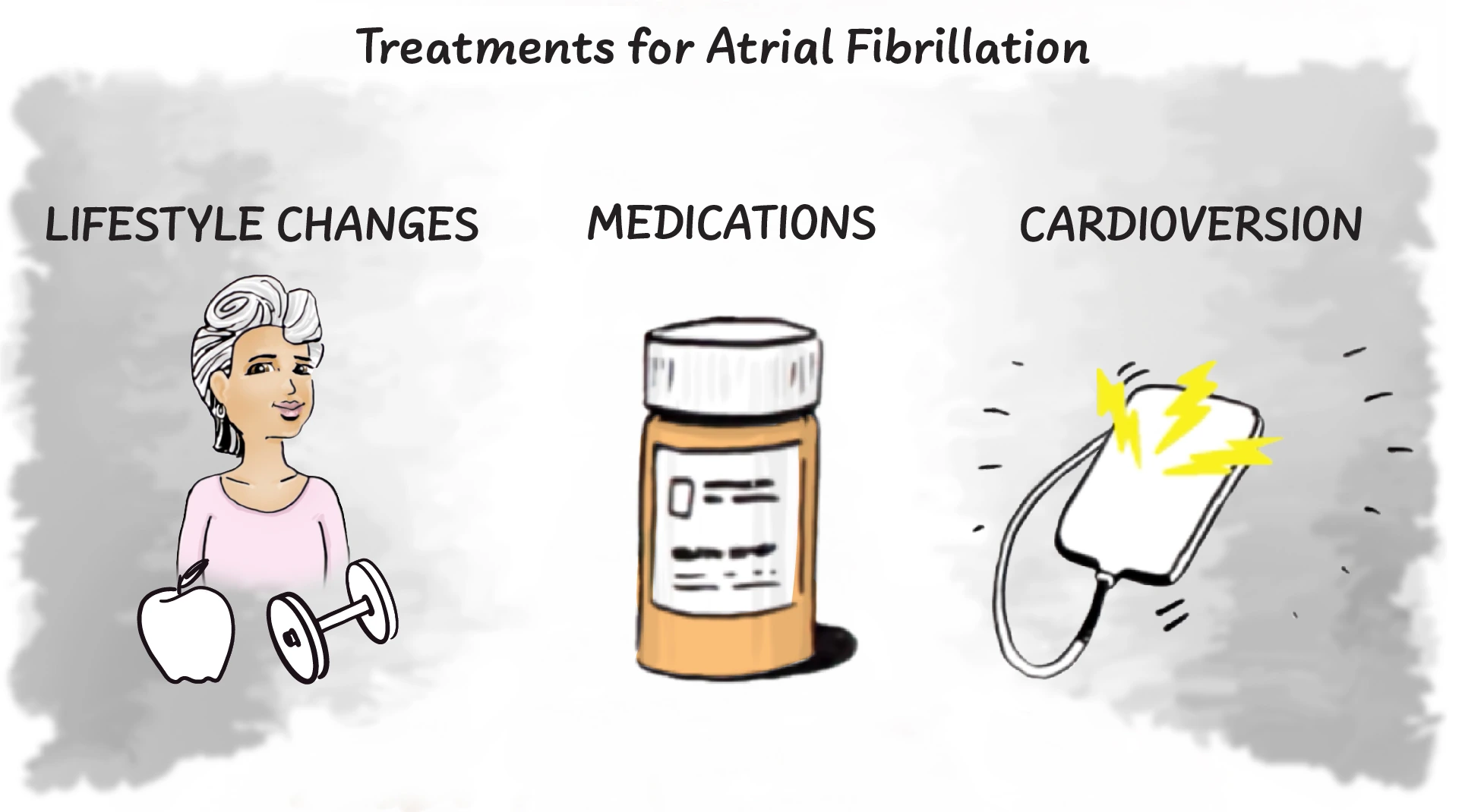 Afib Treatment (JPG)